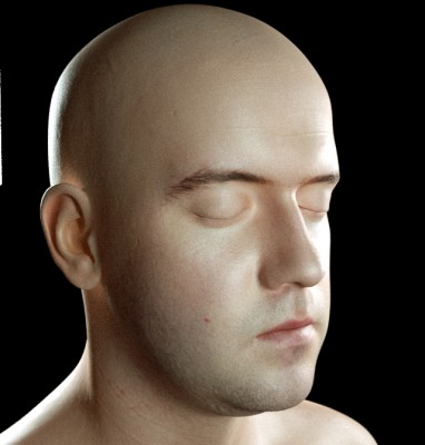Skin7.jpg