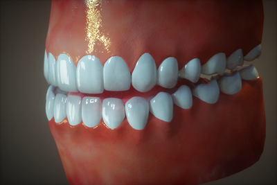 teeth_test.png