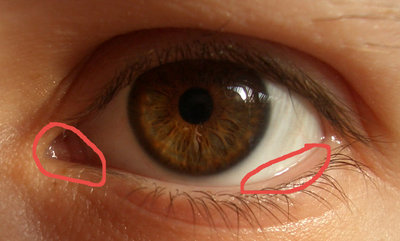 eye.jpg