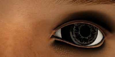 stephanie more eye problems.png