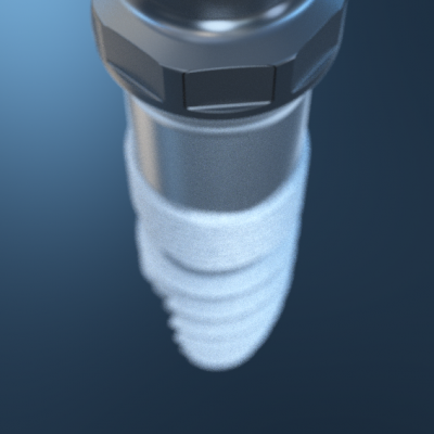 MicroCone_383.png