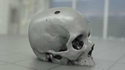 Skull